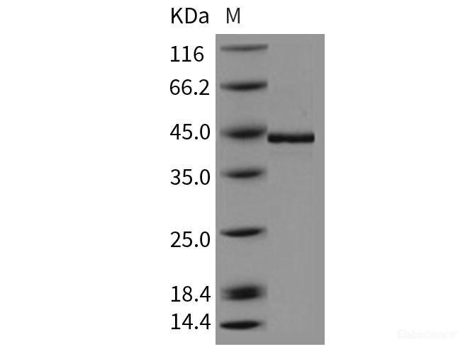 Recombinant Human TCN2 / Transcobalamin-II Protein (His tag)-Elabscience