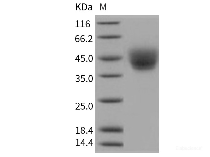 Recombinant Human CD226 / DNAM-1 Protein (His tag)-Elabscience