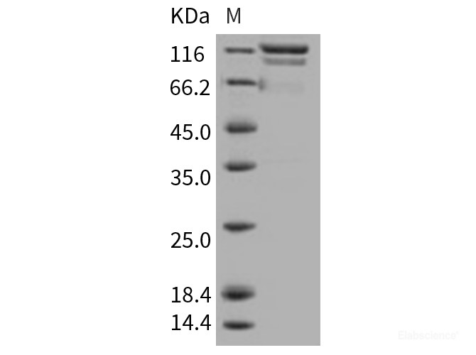 Recombinant Human DC-SIGNR / CD299 / CLEC4M Protein (Fc tag)-Elabscience