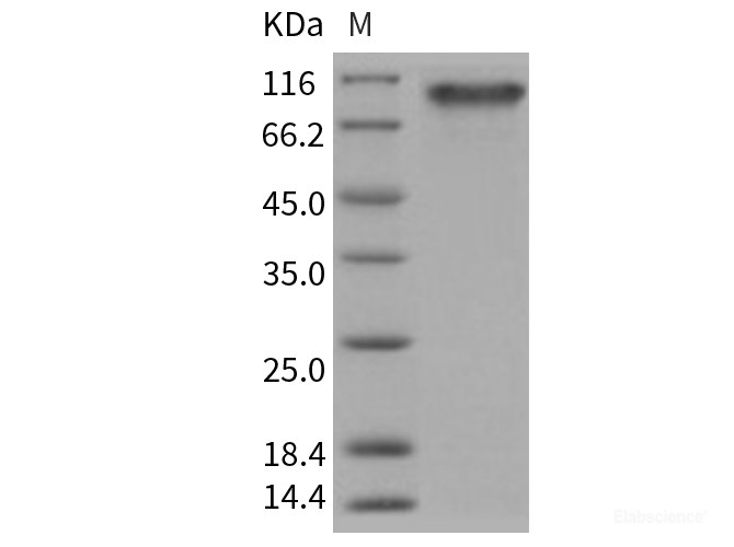 Recombinant Human PDGFRa / CD140a Protein (His tag)-Elabscience
