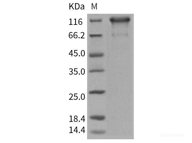 Recombinant Human PDGFRa / CD140a Protein (Fc tag)-Elabscience
