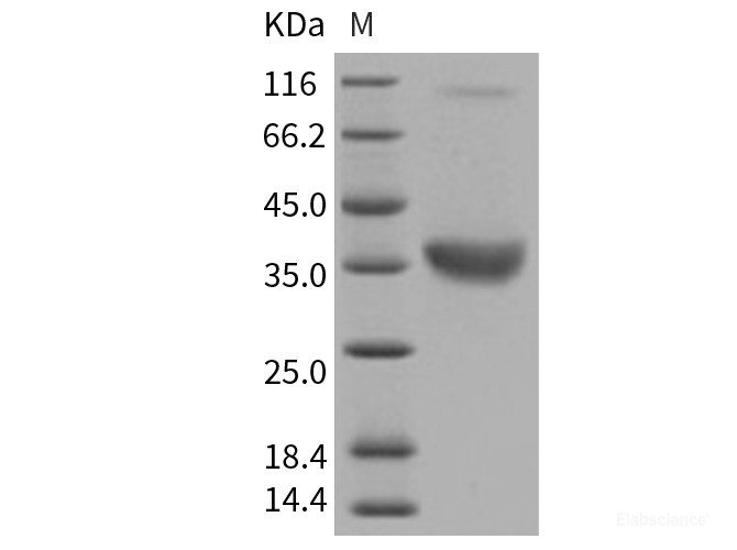 Recombinant Human ACP5 / TRAP Protein (His tag)-Elabscience
