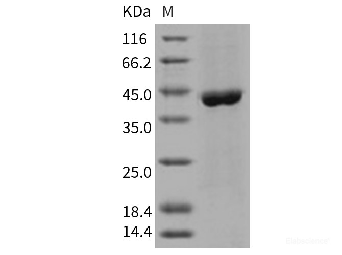 Recombinant Human ACY1 / Aminoacylase-1 Protein (His tag)-Elabscience
