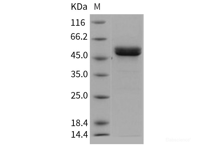 Recombinant Human MMP1 Protein (His tag)-Elabscience