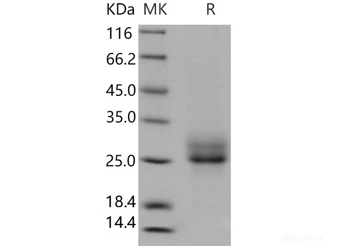 Recombinant Human RELT / TNFRSF19L Protein (His Tag)-Elabscience