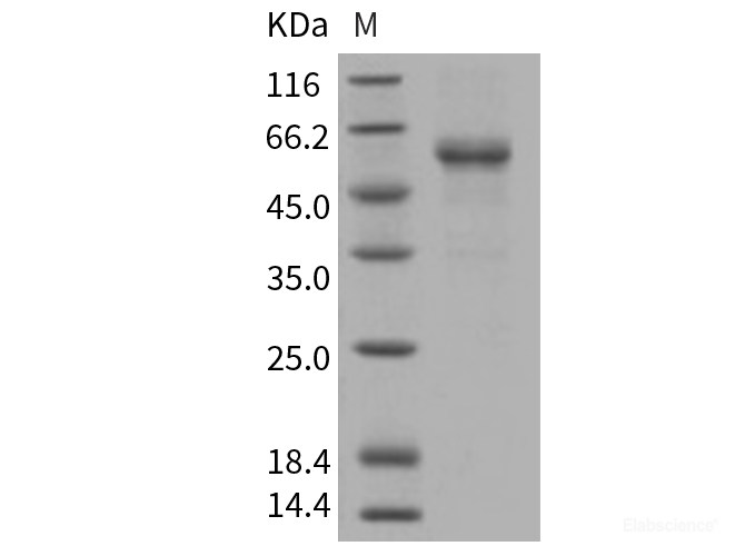 Recombinant Human RELT / TNFRSF19L Protein (His & Fc tag)-Elabscience