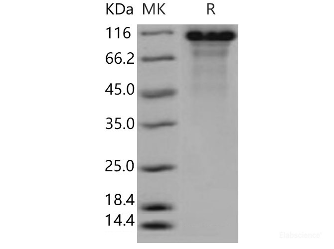 Recombinant Human Kininogen 1 Protein (His Tag)-Elabscience