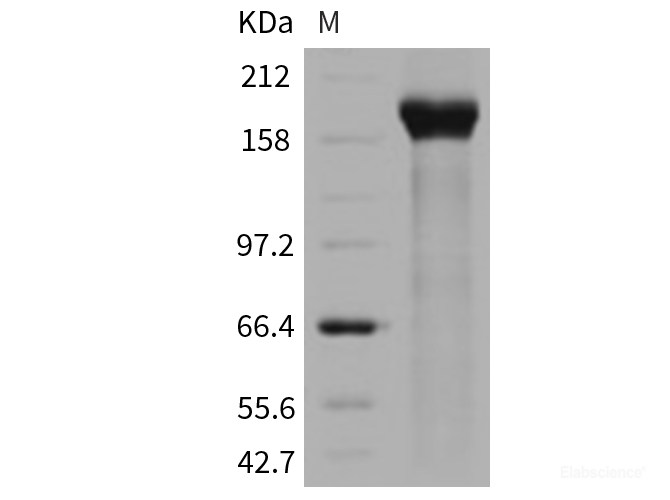 Recombinant Human PAPPA2 / Pappalysin 2 Protein (His tag)-Elabscience
