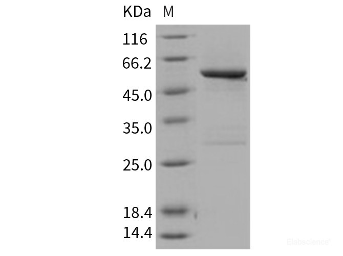 Recombinant Human SPG21 Protein (GST tag)-Elabscience