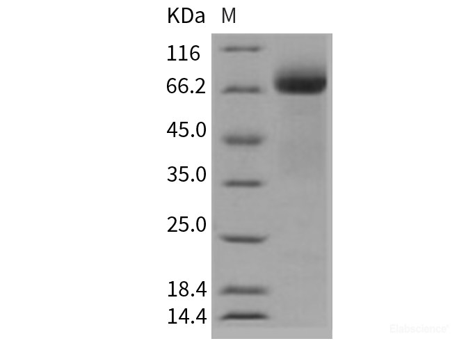 Recombinant Human ADAM15 Protein (His tag)-Elabscience