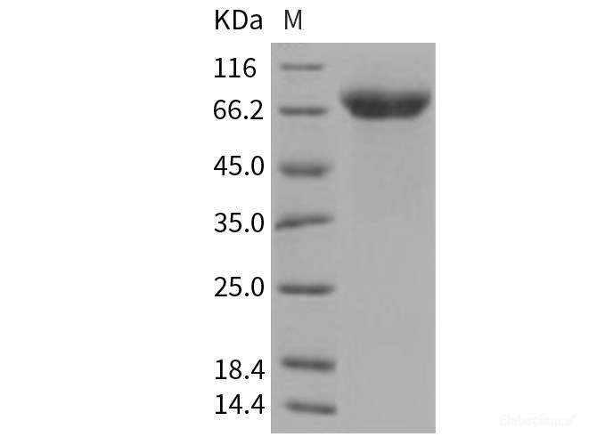 Recombinant Human ADAM15 / MDC15 Protein (His tag)-Elabscience