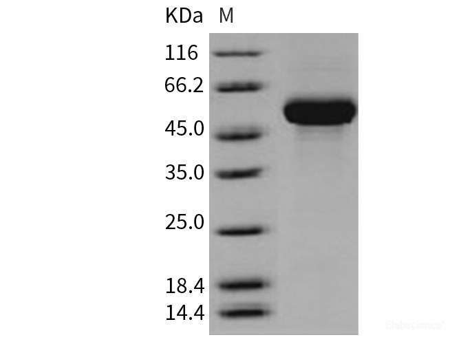 Recombinant Human CD131 / CSF2RB / IL3RB / IL5RB Protein (His tag)-Elabscience
