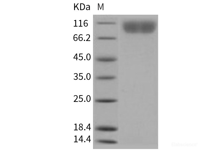 Recombinant Human CD140b / PDGFRB Protein (His tag)-Elabscience