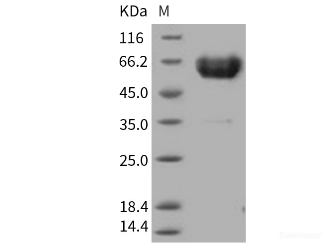 Recombinant Human TREM1 Protein (His & Fc tag)-Elabscience