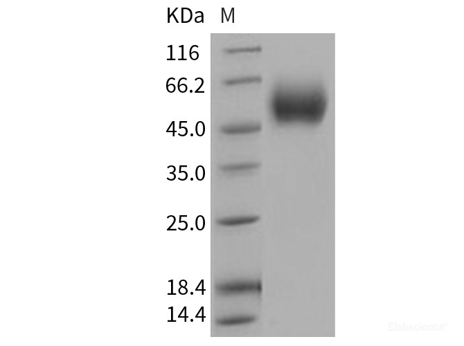 Recombinant Human IL17RD Protein (His tag)-Elabscience