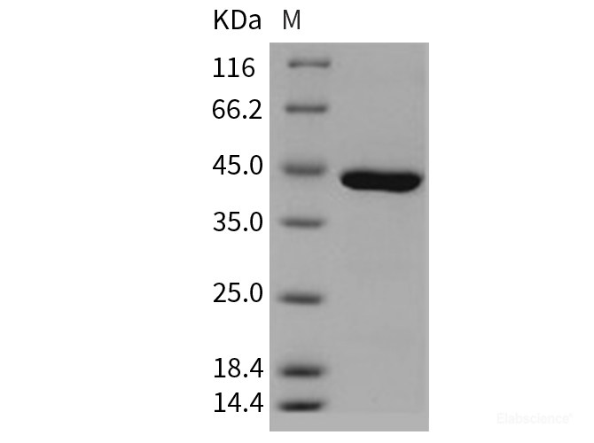 Recombinant Human Carboxypeptidase A1 / CPA1 Protein (His tag)-Elabscience