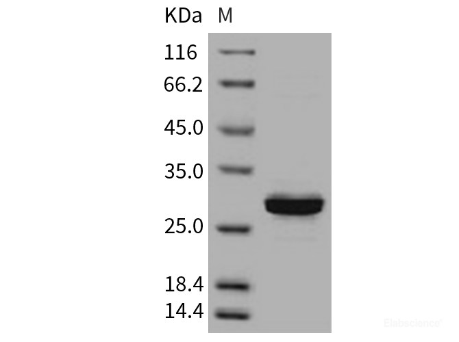 Recombinant Human Carbonic Anhydrase III / CA3 Protein (His tag)-Elabscience