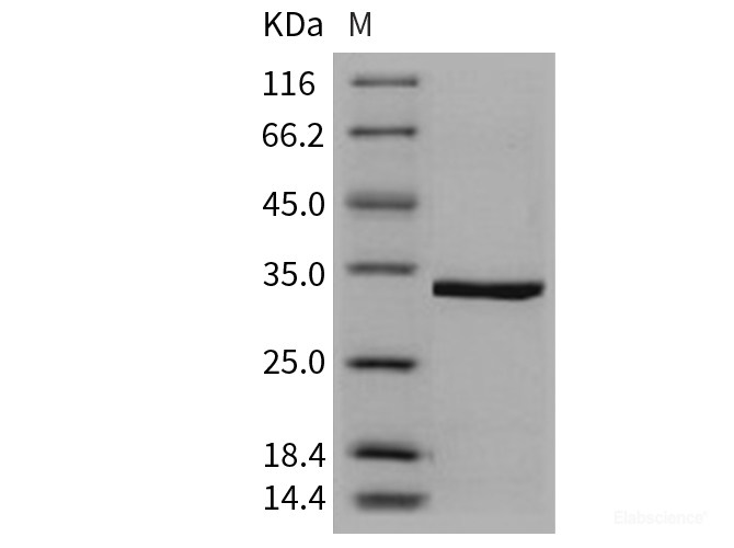 Recombinant Human CA5A / CA-VA Protein (His tag)-Elabscience
