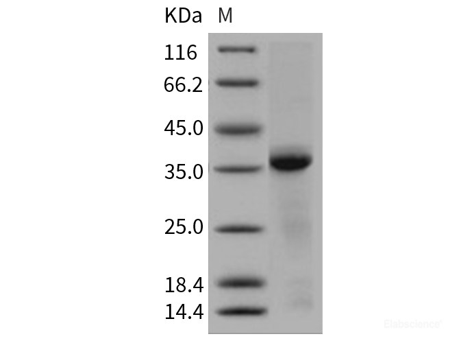 Recombinant Human Cathepsin L1 / CTSL1 Protein (His tag)-Elabscience