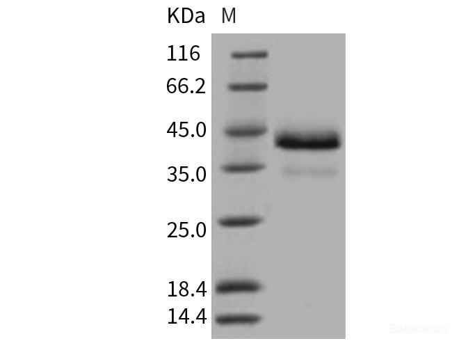 Recombinant Human Cathepsin B / CTSB Protein (His tag)-Elabscience