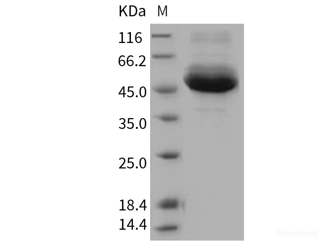 Recombinant Human Cathepsin A / CTSA Protein (His tag)-Elabscience