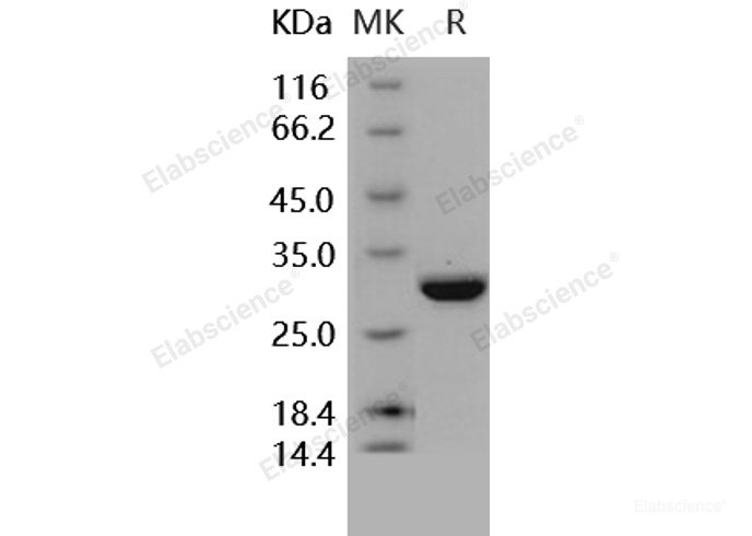 Recombinant Human Carbonic Anhydrase II / CA2 Protein (His tag)-Elabscience