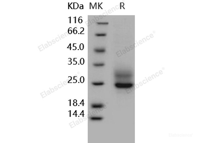 Recombinant Human Frizzled-5 / FZD5 Protein (His tag)-Elabscience