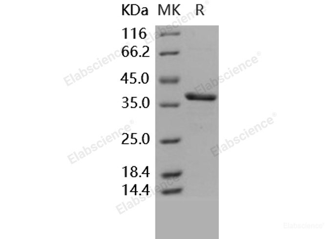 Recombinant Human Carbonic Anhydrase VIII / CA8 Protein (His tag)-Elabscience