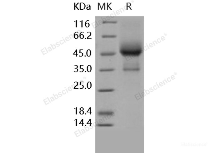 Recombinant Human TGFBR1 / ALK-5 / SKR4 Protein (His & Fc tag)-Elabscience