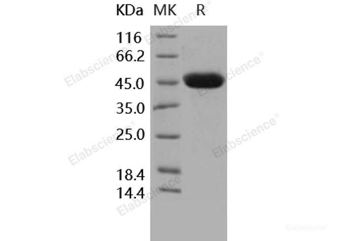 Recombinant Human Carbonic Anhydrase XIV / CA14 Protein (His tag)-Elabscience