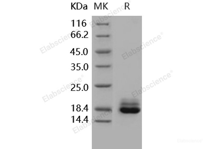 Recombinant Human Cystatin C / CST3 Protein (His tag)-Elabscience