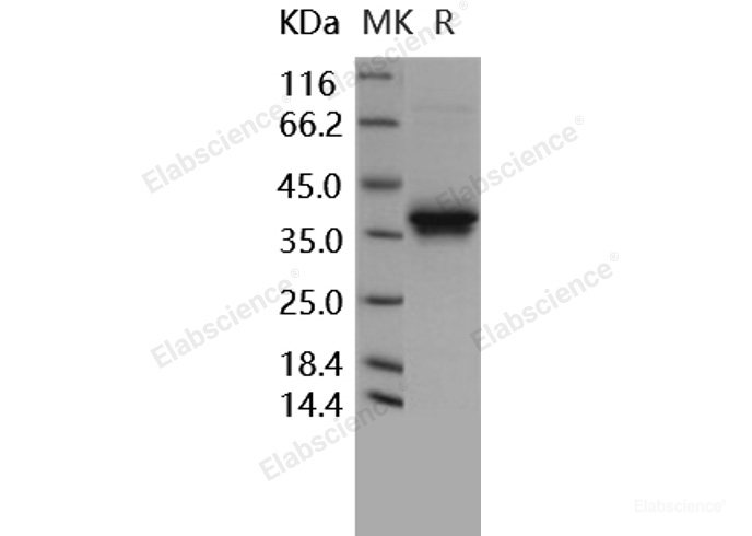 Recombinant Human TNFRSF12A / FN14 / TWEAKR Protein (Fc tag)-Elabscience