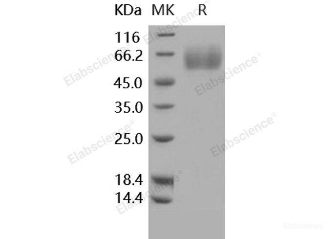 Recombinant Human MSR1 / SCARA1 / CD204 Protein (His tag)-Elabscience