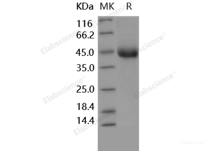 Recombinant Human TNFR2 / CD120b / TNFRSF1B Protein (aa 1-268, 196 Met/Arg, His tag)-Elabscience