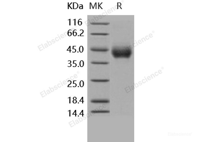 Recombinant Human TNFR2 / CD120b / TNFRSF1B Protein (His tag)-Elabscience