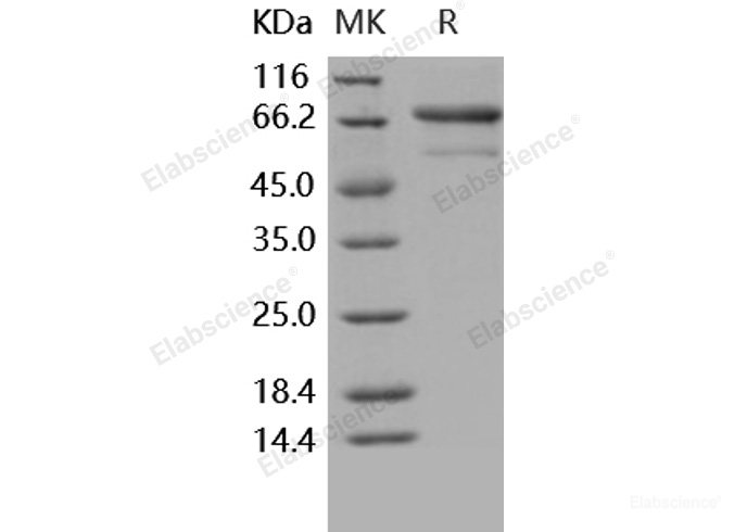 Recombinant Human TNFR2 / CD120b / TNFRSF1B Protein (His & Fc tag)-Elabscience