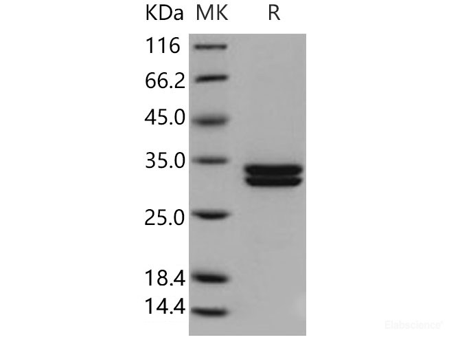 Recombinant Human Kallikrein 7 Protein (His Tag)-Elabscience
