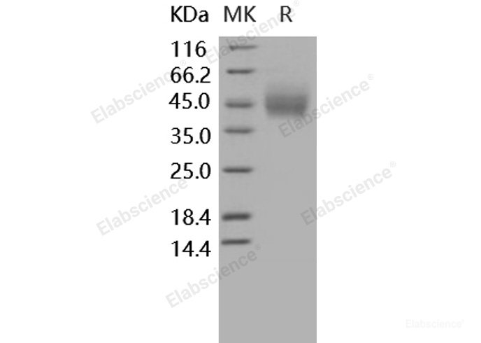 Recombinant Human CD89 / FCAR Protein (His tag)-Elabscience