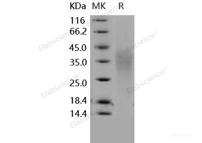Recombinant Human TRAIL R4 / CD264 / TNFRSF10D Protein (His tag)-Elabscience
