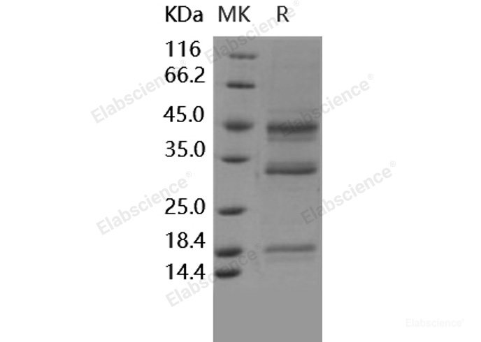 Recombinant Human Hemojuvelin / HFE2 Protein (His tag)-Elabscience