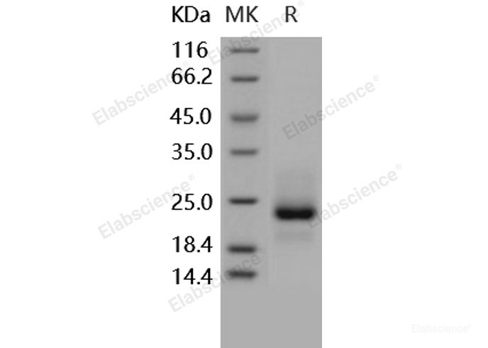 Recombinant Human TRAIL R1 / CD261 / TNFRSF10A Protein (His tag)-Elabscience