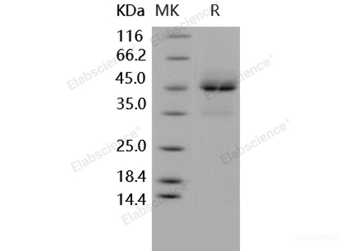 Recombinant Human TRAIL R1 / CD261 / TNFRSF10A Protein (Fc tag)-Elabscience