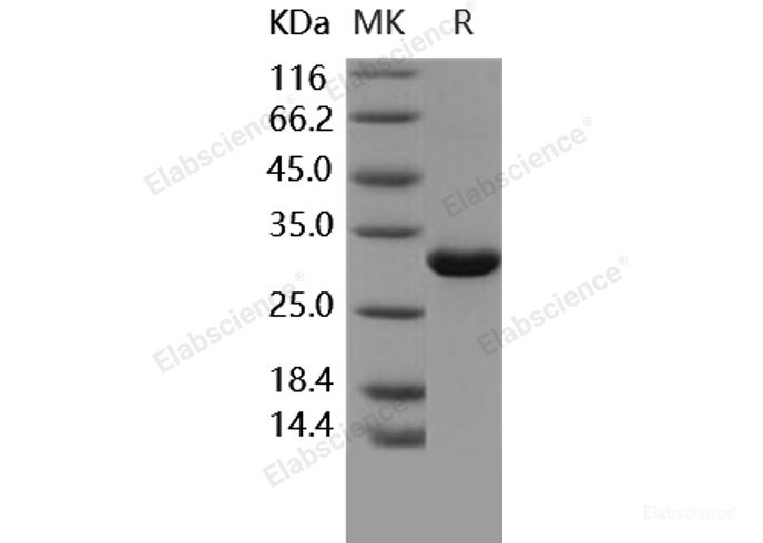 Recombinant Human MBL2 / MBL / COLEC1 Protein-Elabscience