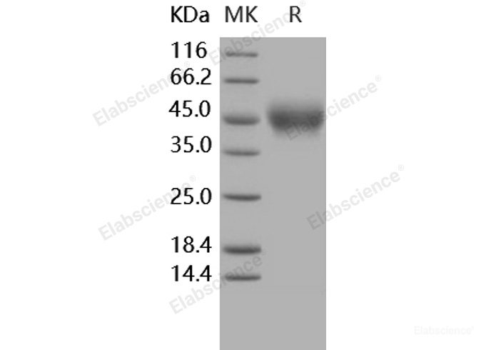 Recombinant Human IL4R / CD124 Protein (His tag)-Elabscience