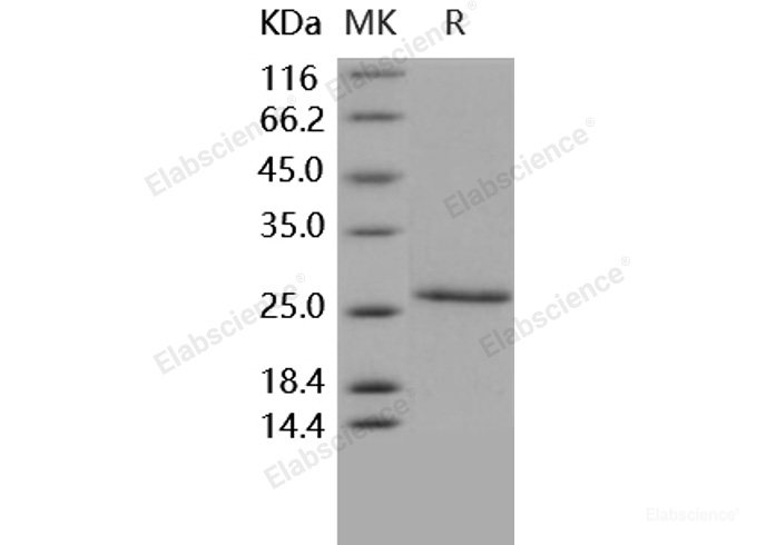 Recombinant Human CD4 / LEU3 Protein (aa 1-208, His tag)-Elabscience