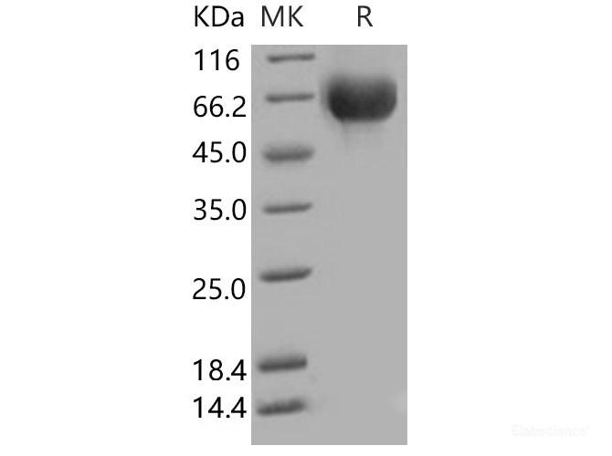 Recombinant Human IL-6R Protein (His Tag)-Elabscience