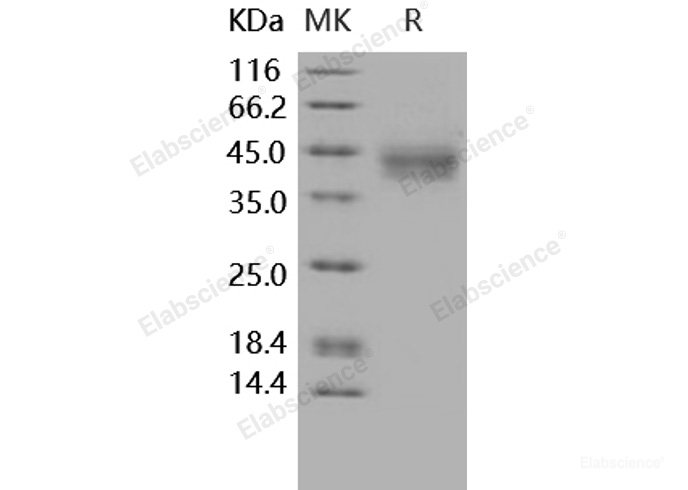 Recombinant Human IL20RA Protein (His tag)-Elabscience
