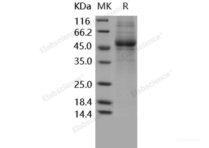 Recombinant Human IL5Ra / CD125 Protein (His tag)-Elabscience