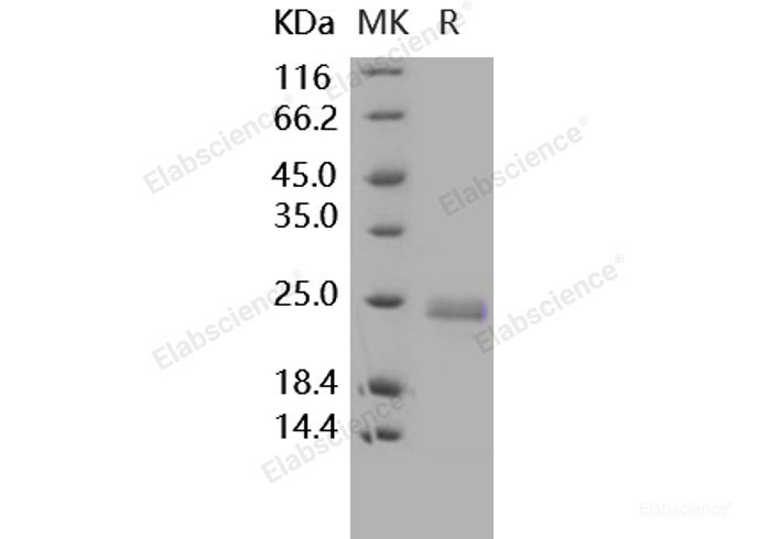 Recombinant Human TNFSF14 / LIGHT / CD258 Protein (His tag)-Elabscience