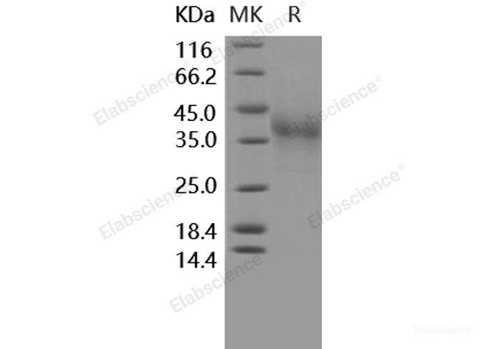 Recombinant Human PD1 / PDCD1 Protein (His tag)-Elabscience